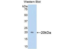 Western Blotting (WB) image for anti-Sex Hormone Binding Globulin (SHBG) (AA 222-358) antibody (ABIN1172841)