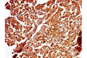 Immunohistochemistry of paraffin-embedded human heart tissue using ABIN7142886 at dilution of 1:100