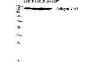 Western Blot (WB) analysis of SH-SY5Y 293T NIH-3T3 COLO205 cells using COL4A2 Polyclonal Antibody.