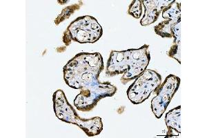 IHC analysis of MRE11 using anti-MRE11 antibody (ABIN7601056). (Mre11 antibody  (AA 278-498))