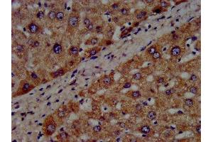 IHC image of ABIN7142850 diluted at 1:300 and staining in paraffin-embedded human liver tissue performed on a Leica BondTM system. (CYP8B1 antibody  (AA 303-440))