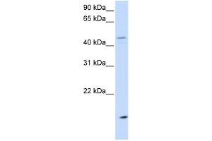 WB Suggested Anti-CETP Antibody Titration: 0.