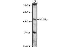 Western blot analysis of extracts of C6 cells, using HCRTR1 antibody (ABIN7267816) at 1:1000 dilution. (HCRTR1 antibody  (AA 150-250))