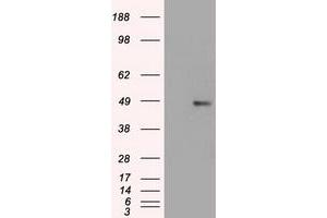 Western Blotting (WB) image for anti-Forkhead Box A1 (FOXA1) (AA 1-473) antibody (ABIN1490773)