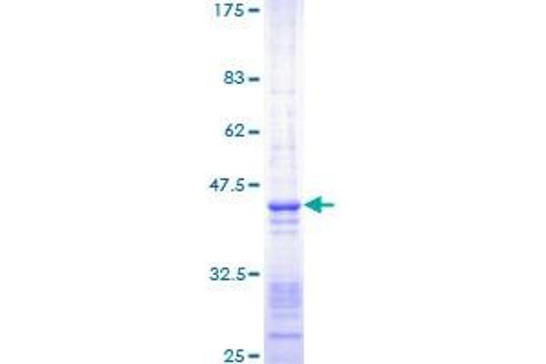 SMARCA4 Protein (AA 1451-1550) (GST tag)