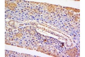 Formalin-fixed and paraffin embedded mouse lymph node tissue labeled with Anti-STAT5 Polyclonal Antibody, Unconjugated  at 1:200 followed by conjugation to the secondary antibody and DAB staining (STAT5A antibody  (AA 61-160))