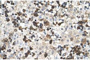 Immunohistochemical staining (Formalin-fixed paraffin-embedded sections) of human liver with HBZ polyclonal antibody  at 4-8 ug/mL working concentration. (HBZ antibody  (N-Term))