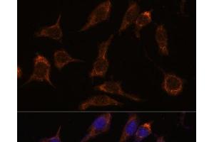 Immunofluorescence analysis of L929 cells using SCGN Polyclonal Antibody at dilution of 1:100. (SCGN antibody)
