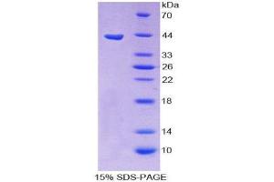 SDS-PAGE (SDS) image for Orexin A (OXA) (AA 33-124) protein (His tag,GST tag) (ABIN2123422) (Orexin A Protein (OXA) (AA 33-124) (His tag,GST tag))