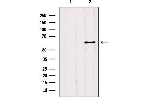 Western blot analysis of extracts from B6F10, using YTHDF2 antibody. (YTHDF2 antibody  (Internal Region))