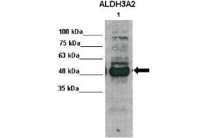 WB Suggested Anti-ALDH3A2 Antibody    Positive Control:  Lane1: 30ug human primary hepatocytes   Primary Antibody Dilution :   1:1000  Secondary Antibody :   Anti-rabbit-HRP   Secondry Antibody Dilution :   1:5000  Submitted by:  Takeshi Saito, USC Keck School of Medicine (ALDH3A2 antibody  (Middle Region))