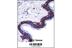 DSG1 Antibody immunohistochemistry analysis in formalin fixed and paraffin embedded human skin tissue followed by peroxidase conjugation of the secondary antibody and DAB staining. (Desmoglein 1 antibody  (AA 471-499))
