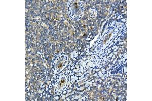 Immunohistochemistry of paraffin-embedded human tonsil using MMP9 Rabbit pAb (ABIN6134758, ABIN6143921, ABIN6143924 and ABIN6215080) at dilution of 1:100 (40x lens). (MMP 9 antibody  (AA 400-500))