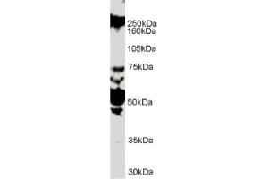 Image no. 1 for anti-Roundabout, Axon Guidance Receptor, Homolog 1 (ROBO1) (Internal Region) antibody (ABIN374636) (ROBO1 antibody  (Internal Region))