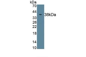 Detection of Recombinant C4, Rat using Polyclonal Antibody to Complement Component 4 (C4) (Complement C4 antibody  (AA 1419-1737))