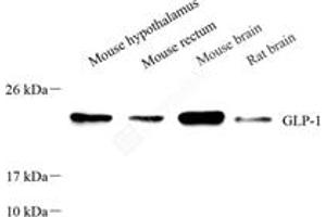 Western blot analysis of GLP1 (ABIN7074052),at dilution of 1: 800 (GLP-1 antibody)