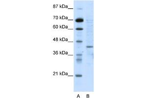WB Suggested Anti-RING1 Antibody Titration:  5.