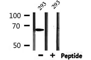Western blot analysis of extracts from 293, using PIAS2 Antibody. (PIAS2 antibody)