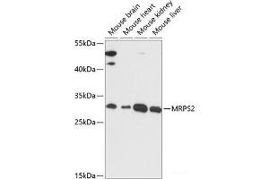 Western blot analysis of extracts of various cell lines using MRPS2 Polyclonal Antibody at dilution of 1:3000. (MRPS2 antibody)