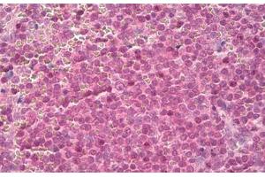 Image no. 2 for anti-14-3-3 zeta (YWHAZ) (AA 200-245) antibody (ABIN1491173) (14-3-3 zeta antibody  (AA 200-245))