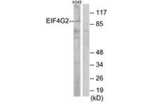 Western blot analysis of extracts from A549 cells, using EIF4G2 Antibody. (EIF4G2 antibody  (AA 41-90))