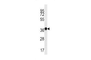 Western blot analysis in WiDr cell line lysates (35ug/lane). (MUC15 antibody  (C-Term))