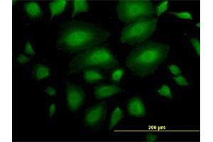 Immunofluorescence of purified MaxPab antibody to ANKS1 on HeLa cell.