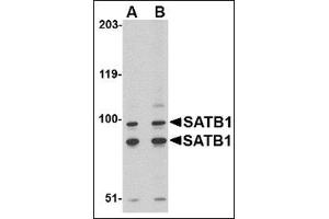Western blot analysis of SATB1 in A20 cell lysate with this product at (A) 2 and (B) 4 μg/ml. (SATB1 antibody  (C-Term))