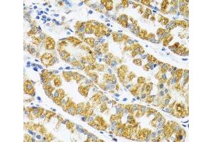 Immunohistochemistry of paraffin-embedded Human stomach using POLG2 Polyclonal Antibody at dilution of 1:100 (40x lens). (POLG2 antibody)
