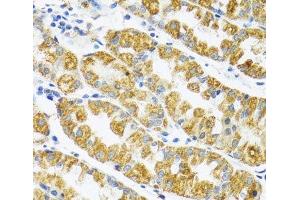 Immunohistochemistry of paraffin-embedded Human stomach using POLG2 Polyclonal Antibody at dilution of 1:100 (40x lens).