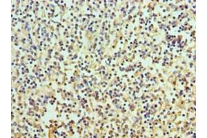 Immunohistochemistry of paraffin-embedded human spleen tissue using ABIN7167113 at dilution of 1:100 (RICTOR antibody  (AA 1-245))