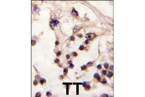Formalin-fixed and paraffin-embedded human testis tissue reacted with TESK2 antibody , which was peroxidase-conjugated to the secondary antibody, followed by DAB staining. (TESK2 antibody  (AA 210-240))