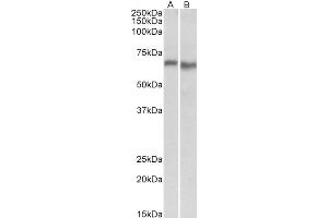 Western Blotting (WB) image for anti-Protein Kinase, AMP-Activated, alpha 2 Catalytic Subunit (PRKAA2) antibody (ABIN5893753) (PRKAA2 antibody)