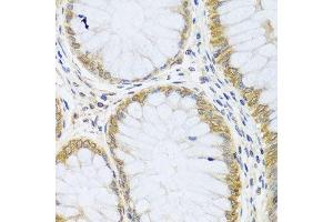 Immunohistochemistry (Paraffin-embedded Sections) (IHC (p)) image for anti-ADP Ribosylation Factor Like GTPase 6 (ARL6) (AA 1-186) antibody (ABIN6137113)