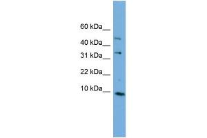 WB Suggested Anti-C16orf61 Antibody Titration: 0. (C16orf61 antibody  (Middle Region))