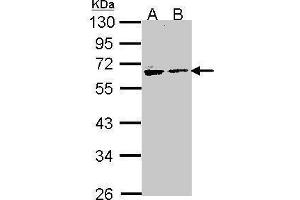WB Image Sample (30 ug of whole cell lysate) A: H1299 B: Hela 10% SDS PAGE antibody diluted at 1:1000 (Arylsulfatase A antibody)