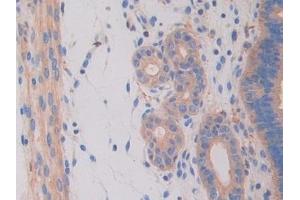 Immunohistochemistry (IHC) image for anti-Hexosaminidase B (Beta Polypeptide) (HEXB) (AA 294-435) antibody (ABIN7438139)