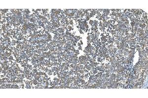 IHC analysis of DRP1/DNM1L using anti-DRP1/DNM1L antibody (ABIN7602180).