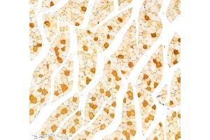 Immunohistochemistry analysis of paraffin-embedded rat muscle using,MYH7 (ABIN7075623) at dilution of 1: 1000 (Slow Skeletal Myosin Heavy Chain antibody)