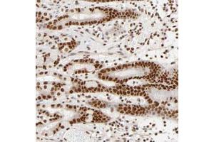 Immunohistochemical staining (Formalin-fixed paraffin-embedded sections) of human stomach with ILKAP polyclonal antibody  shows strong nuclear positivity in glandular cells.
