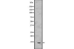 Western blot analysis of Parvalbumin using HeLa whole cell lysates (PVALB antibody  (C-Term))