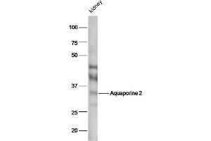 Western Blotting (WB) image for anti-Aquaporin 2 (Collecting Duct) (AQP2) (AA 171-271) antibody (ABIN707576)