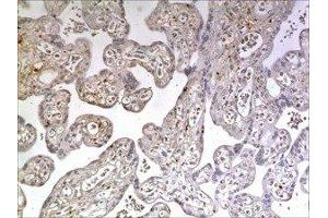 Immunohistochemistry (IHC) image for anti-Interleukin 15 Receptor, alpha (IL15RA) (AA 31-172) antibody (ABIN1983257) (IL15RA antibody  (AA 31-172))