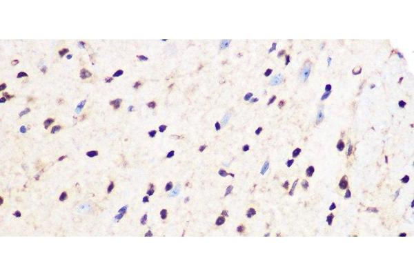 PCIF1 antibody