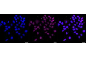 Immunocytochemical staining of HAP-1 cells with NK2 homeobox 2 antibody (ABIN7799610), 1:1,000). (Recombinant Nkx2-2 antibody)