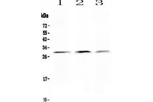 Anti-Kallikrein 2 antibody, Western blottingAll lanes: Anti Kallikrein 2  at 0. (Kallikrein 2 antibody  (C-Term))