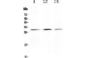Anti-Kallikrein 2 antibody, Western blottingAll lanes: Anti Kallikrein 2  at 0. (Kallikrein 2 antibody  (C-Term))