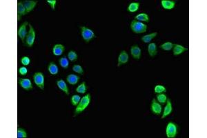Immunofluorescent analysis of PC-3 cells using ABIN7171684 at dilution of 1:100 and Alexa Fluor 488-congugated AffiniPure Goat Anti-Rabbit IgG(H+L) (TECPR2 antibody  (AA 516-783))