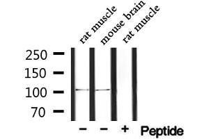 Western blot analysis of extracts from rat muscle and mouse brain, using PDE2A Antibody.