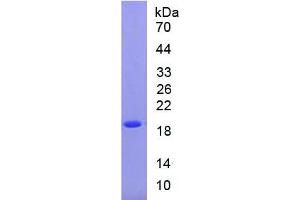 SDS-PAGE of Protein Standard from the Kit (Highly purified E. (SOD1 ELISA Kit)